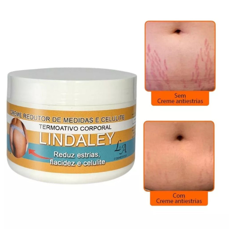 Creme Removedor de Estrias