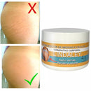 Creme Removedor de Estrias